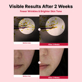 Yam Mucin ABCE Boosting Bundle