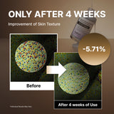Suero exfoliante para puntos negros con arroz negro NIDA