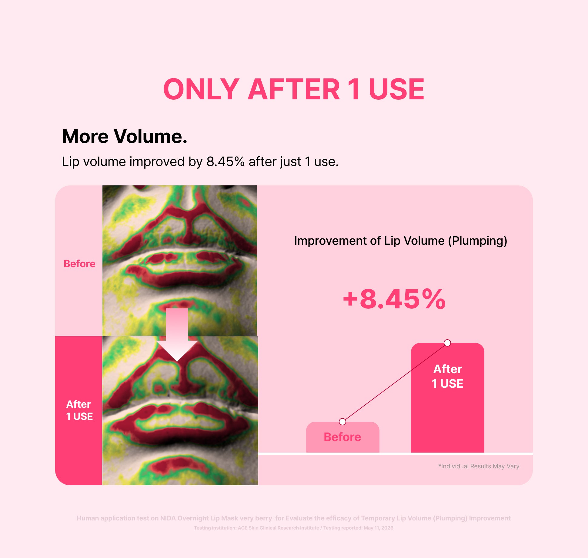 Escaneos del volumen de los labios con mapa de color antes y después de 1 uso