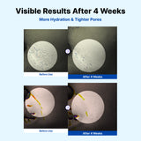 Set de crema NIDA Youthful Formula™ y crema para ojos Revive